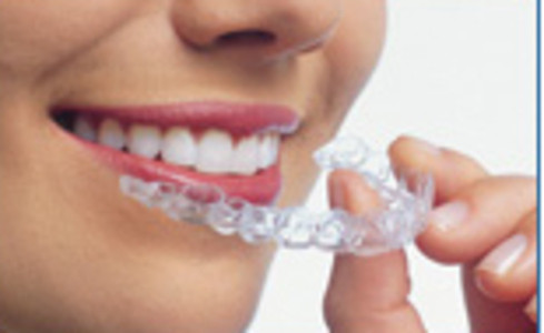 Invisalign Retainers'