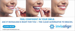 Invisalign Express 5'