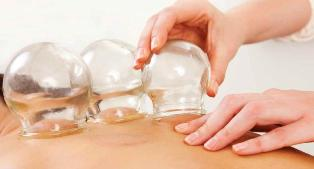 Cupping Massage Los Angeles'