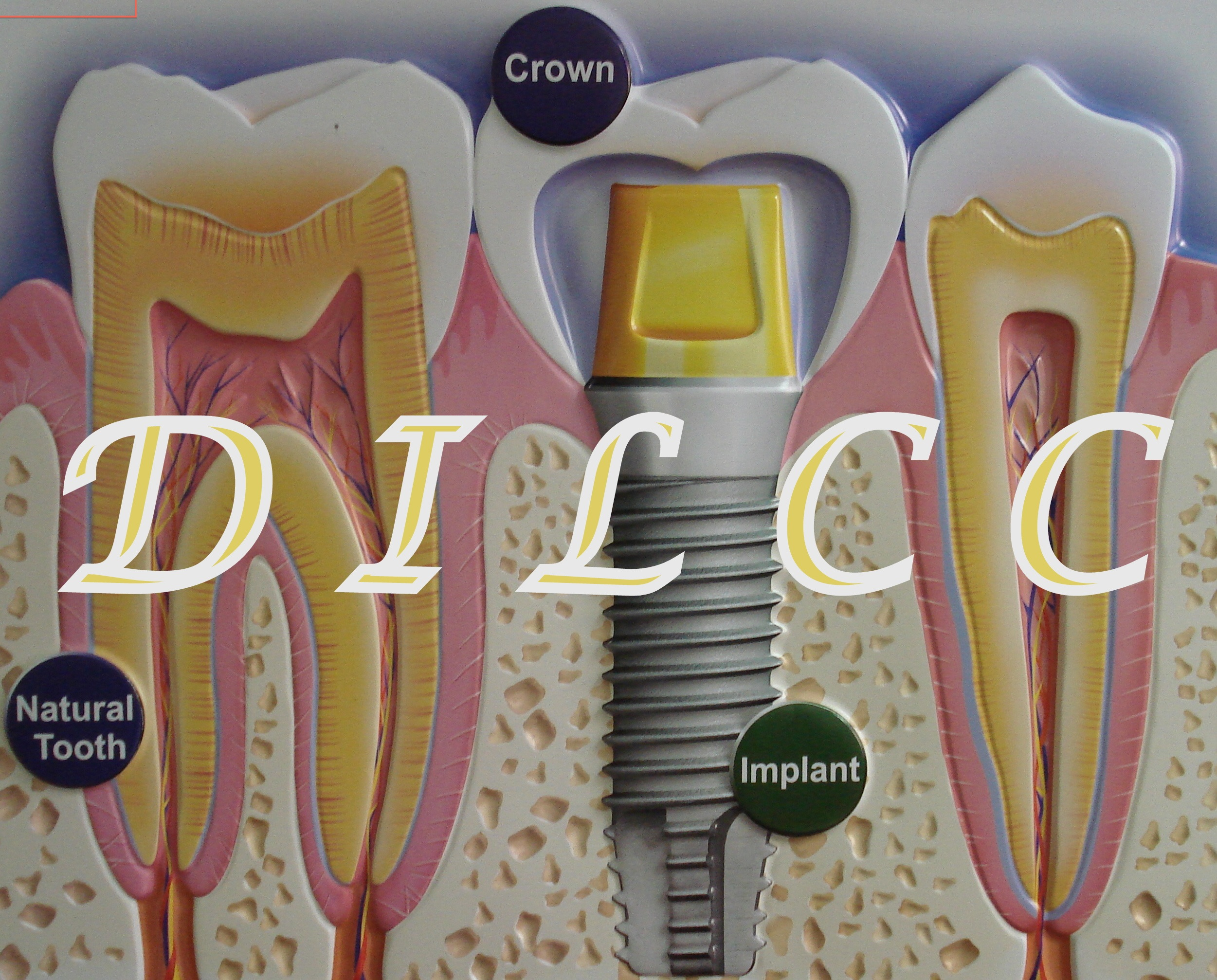 Company Logo For Dental Implant Laser Cosmetic Centre'