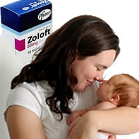 zoloft birth'