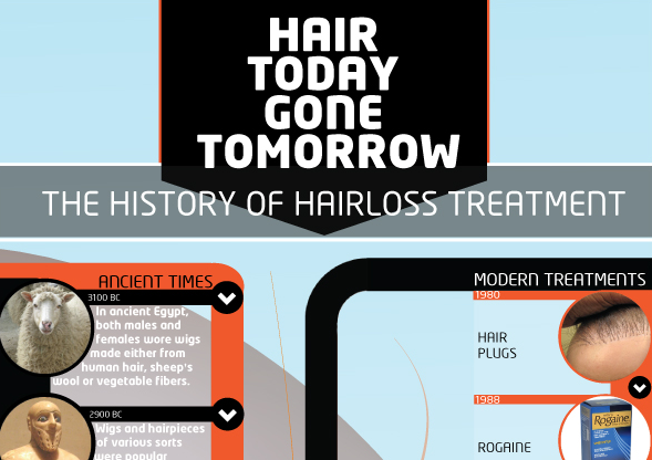 History of Hair Loss Treatments Infographic