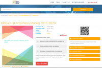 Global Hip Prosthesis Market 2016 - 2020