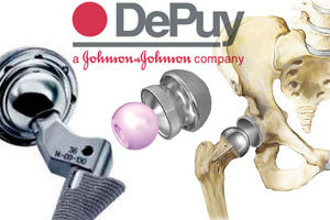 Depuy Pinnacle Lawsuits