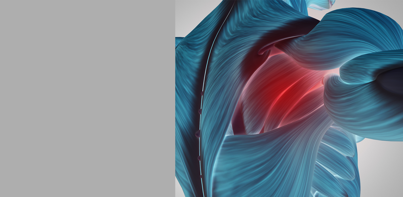 Regenera Prolotherapy'