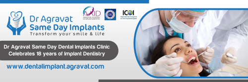 Same_day_teeth_implants_in_Ahmedabad_Gujarat_India.png'