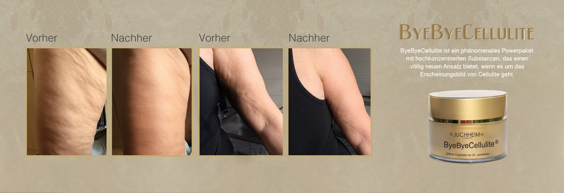 Cellulitetreatment.eu