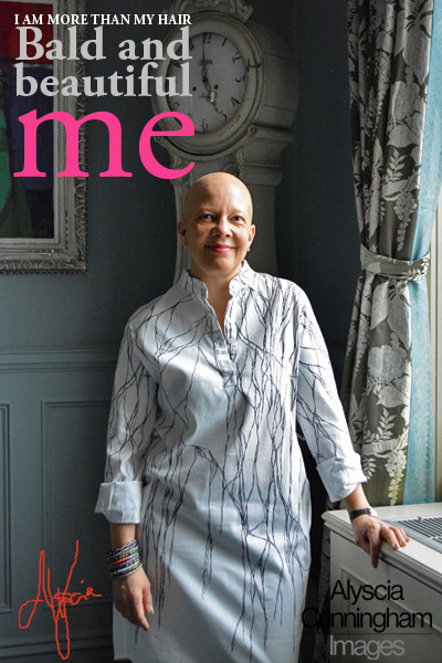 Bald and Beautiful Me