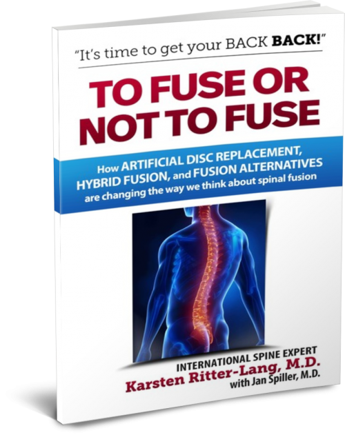 To Fuse or Not To Fuse Book'