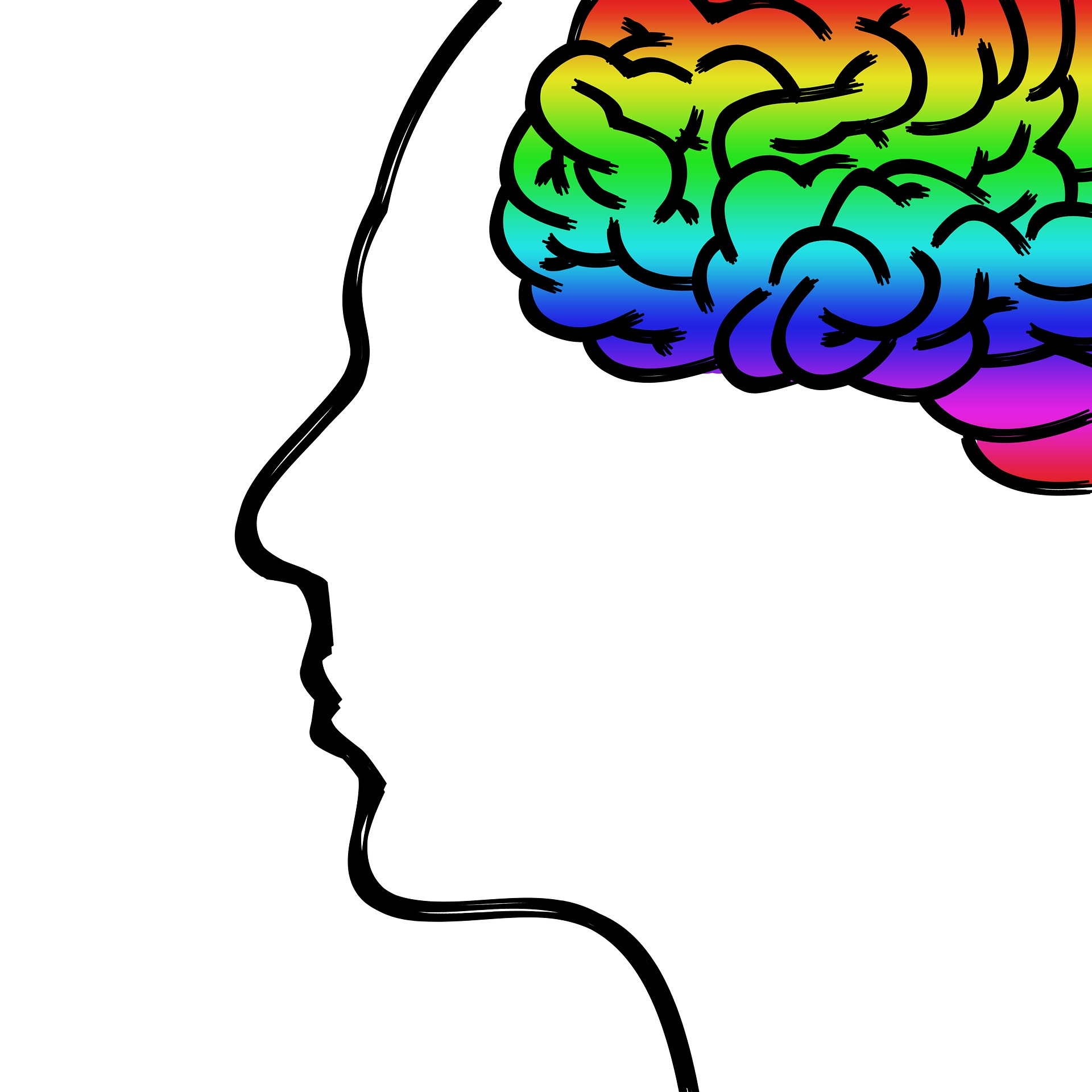 What is a concussion'