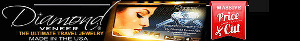 Diamond_veneer'