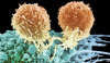Chimeric Antigen Receptor (CAR) T cell Immunotherapy'