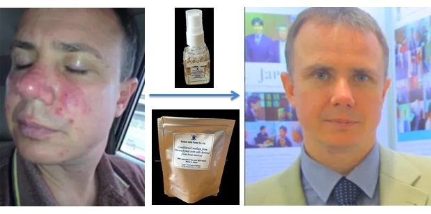 Patient_before-after