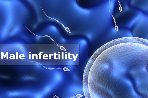 Male Infertility Market