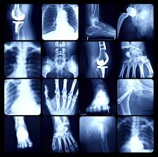 Medical Imaging Informatics Market