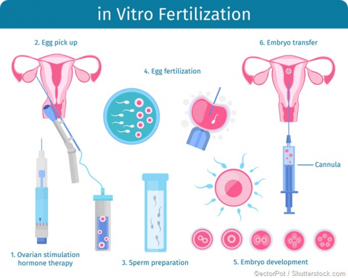 Europe In Vitro Fertilization (IVF) Market'