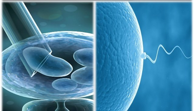 France IVF Services Market