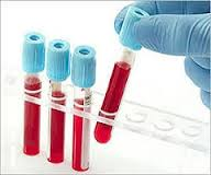 Acute Lymphocytic/Lymphoblastic Leukemia Therapeutics Market'