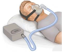 Anti-Snoring Devices Market'