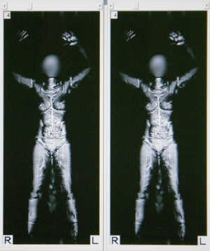 Millimeter Wave Technology Market