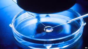 In vitro fertilizatio