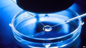 In vitro fertilizatio'