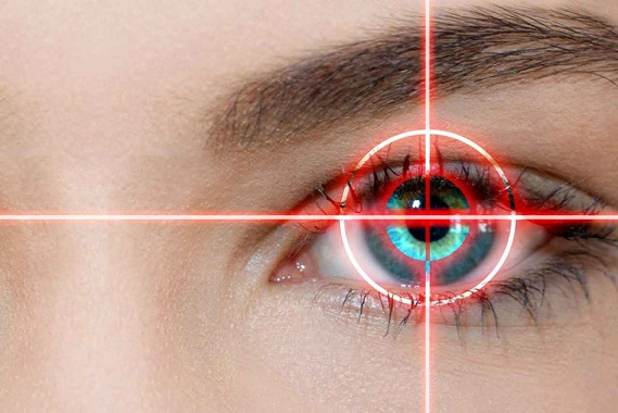Medical Lasers Market'