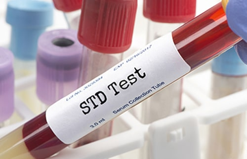 STD Testing (Sexually Transmitted Diseases Testing) Market'