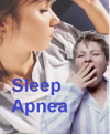 Sleep Apnea'