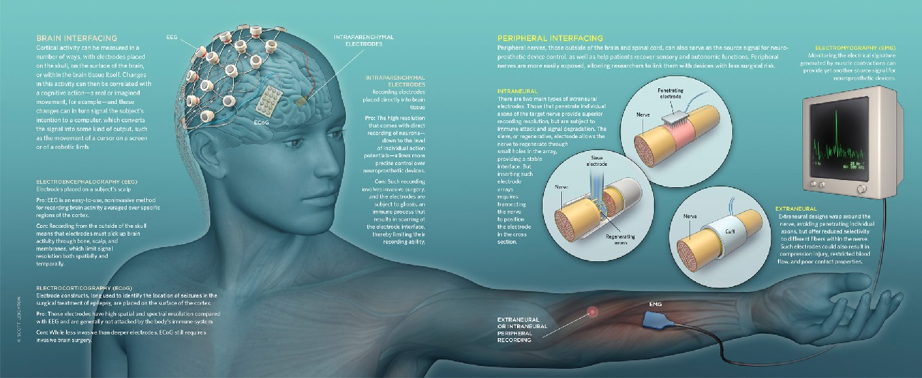 Neuroprosthetics Market