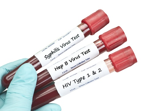 Asia Pacific Sexually Transmitted Diseases (STDs) Testing M