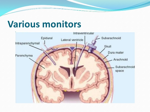 Intra-Cranial Pressure Monitors