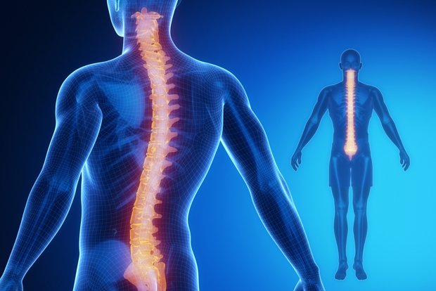 Spinal Implants'