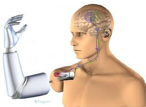 Microelectronic Medical Implants Market'