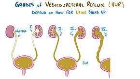 Vesicoureteral Reflux Market'