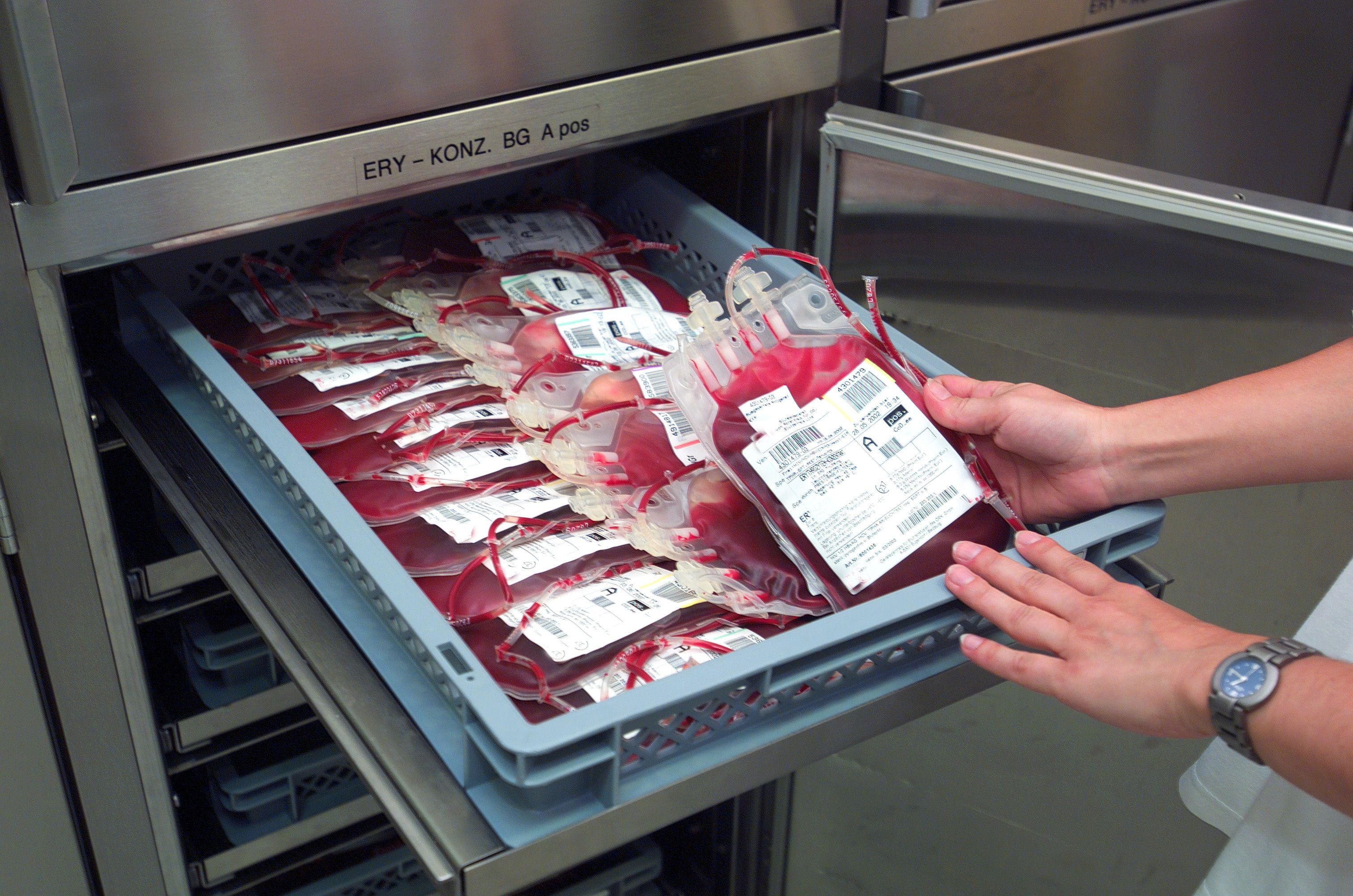 Blood Transfusion Diagnostics