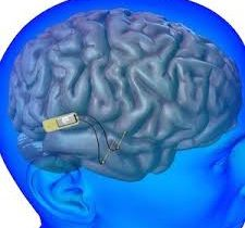 Microelectronic Medical Implants'