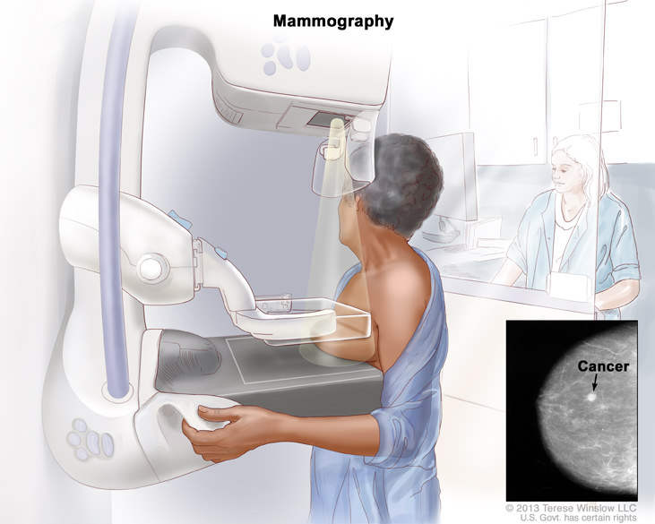 Mammography Market