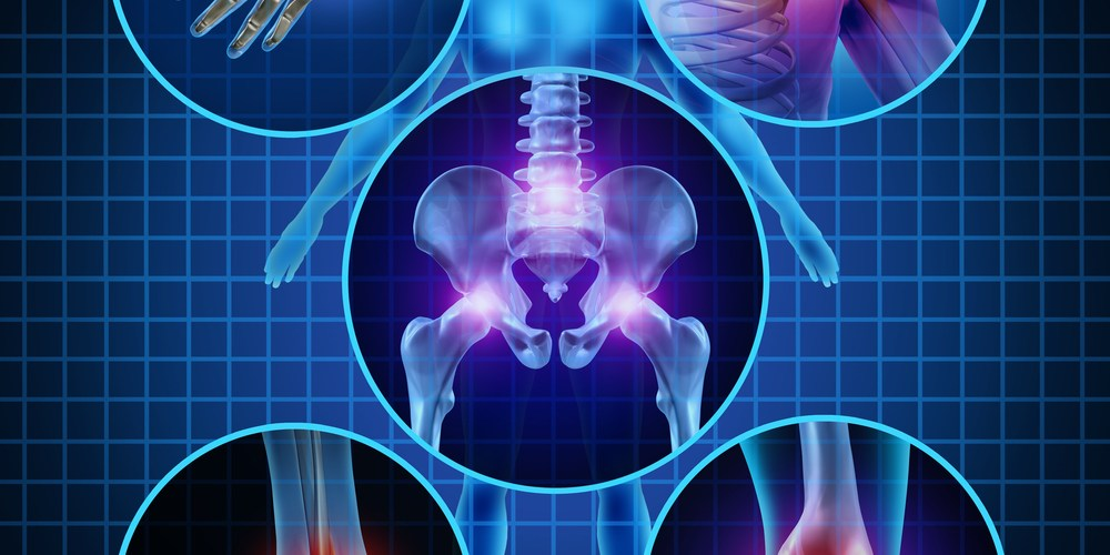 Orthopedic Trauma Devices'