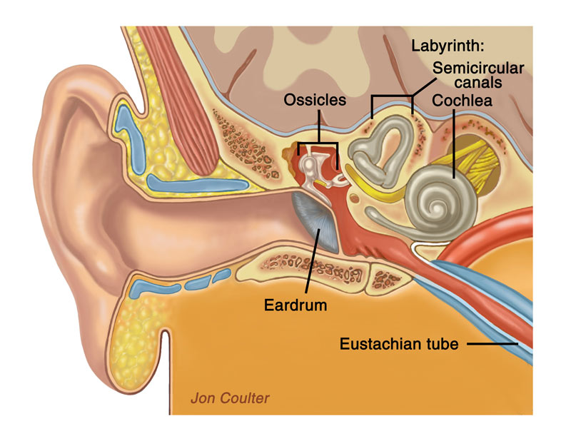 Meniere’s Disease