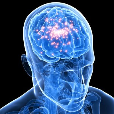 Serotonin Syndrome Market