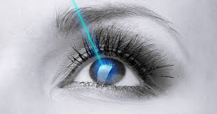 LASIK Eye Surgery Market'