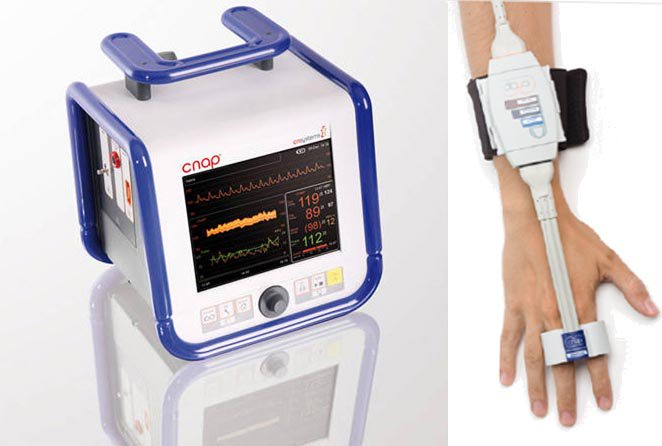 Non-Invasive Monitoring Device Market'