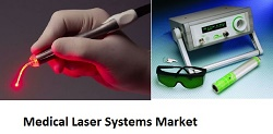 Medical Laser Systems Market'