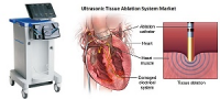 Ultrasonic Tissue Ablation System Market Players, Product,An