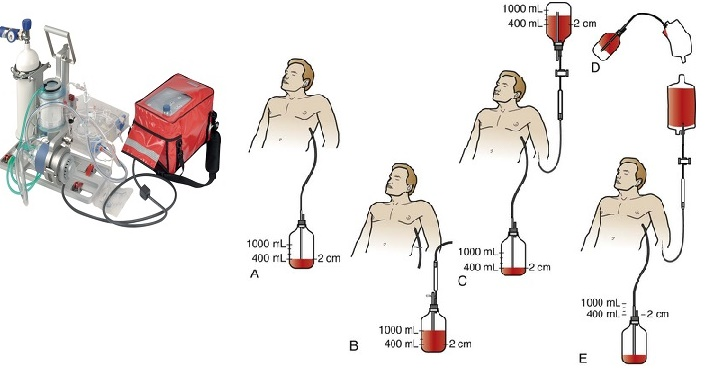 Cardiopulmonary Auto-transfusion System Market