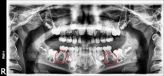 Dental Imaging Industry'