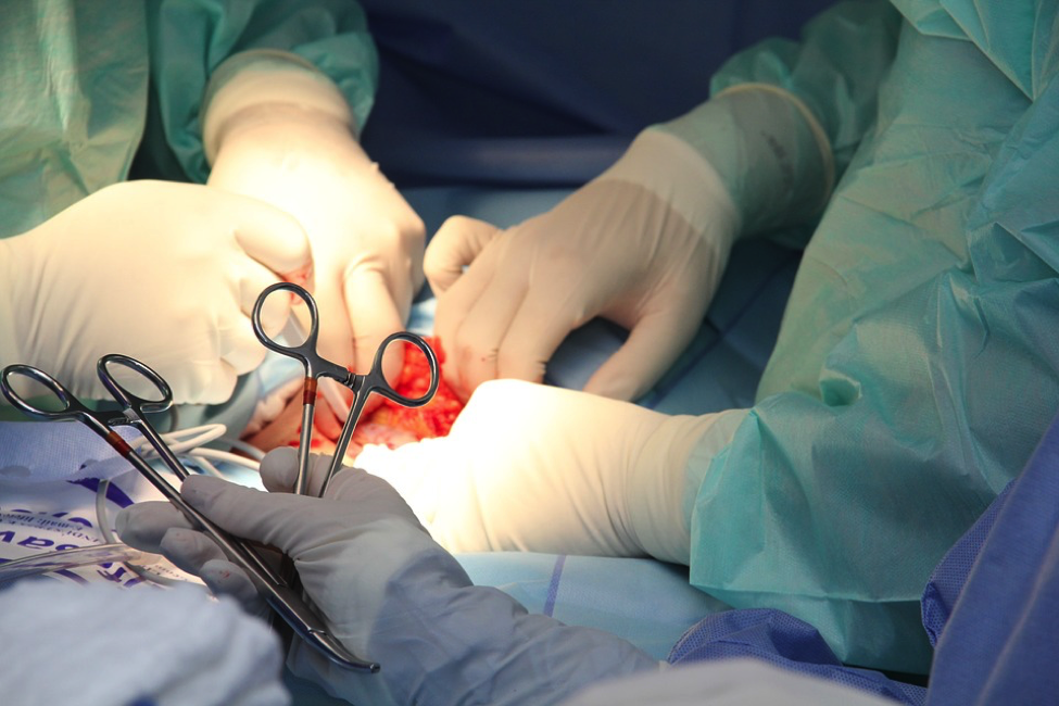 beverly hills hernia surgery
