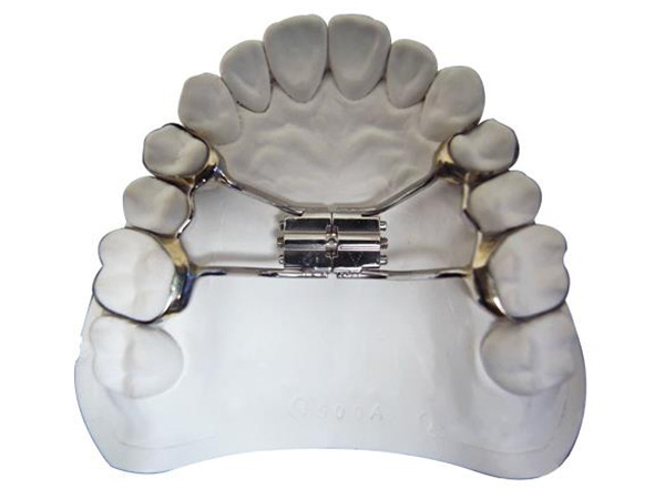 Orthodontic Services China'