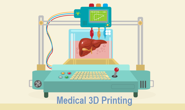 Global Medical 3D Printing market'